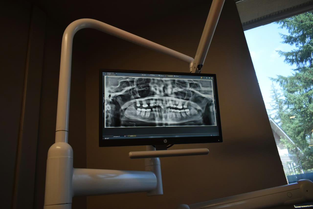 Panoramaröntgen auf dem Monitor im Behandlungszimmer